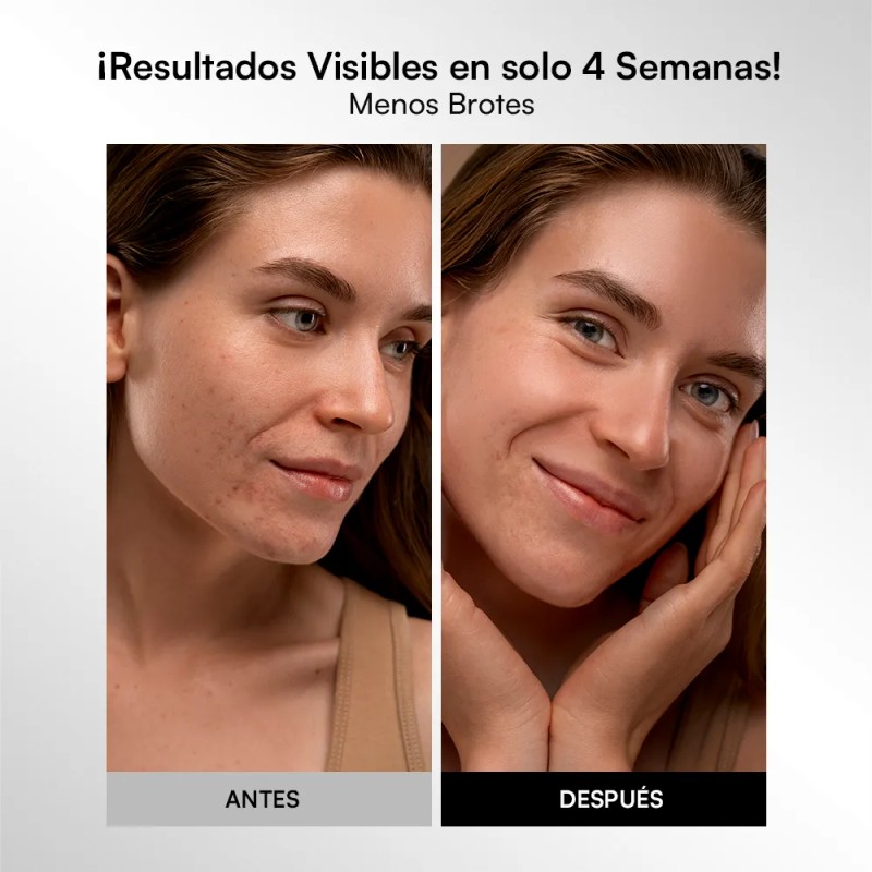 Inia Máscara Led Facial Para El Rostro De 4 Modos