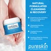 Scalp Cream for Psoriasis Folliculitis, Helps Relieve Itching Flaking, with