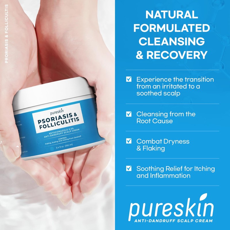 Scalp Cream for Psoriasis Folliculitis, Helps Relieve Itching Flaking, with