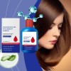 Champú Anticaspa Oil Control 300 Ml Scalp Nourish Para Hombr