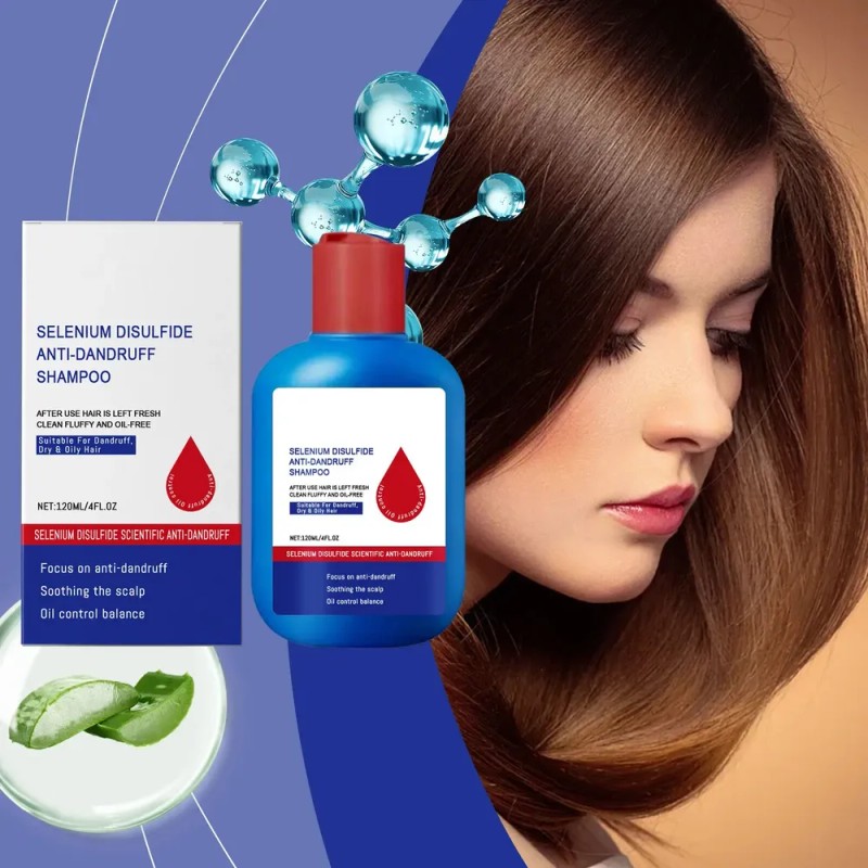 Champú Anticaspa Oil Control 300 Ml Scalp Nourish Para Hombr