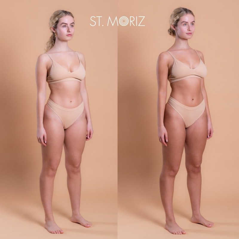 St. Moriz Golden Glow Lotion with Self-Tanning Effect, 200 ml