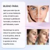 2pc Acné Limpiador Loción Secante Facial Crema Hidratante