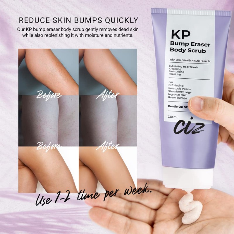 KP Bump Eraser Body Scrub: Keratosis Pilaris Treatment for Strawberry