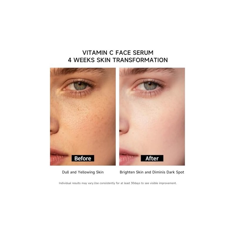 Sérum Facial De Vitamina C Con Glutatión, Ácido Hialurónico 4D