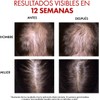 Vichy Dercos R.E.G.EN Booster Sérum Capilar Anti-Caída Dermatológico 90ml