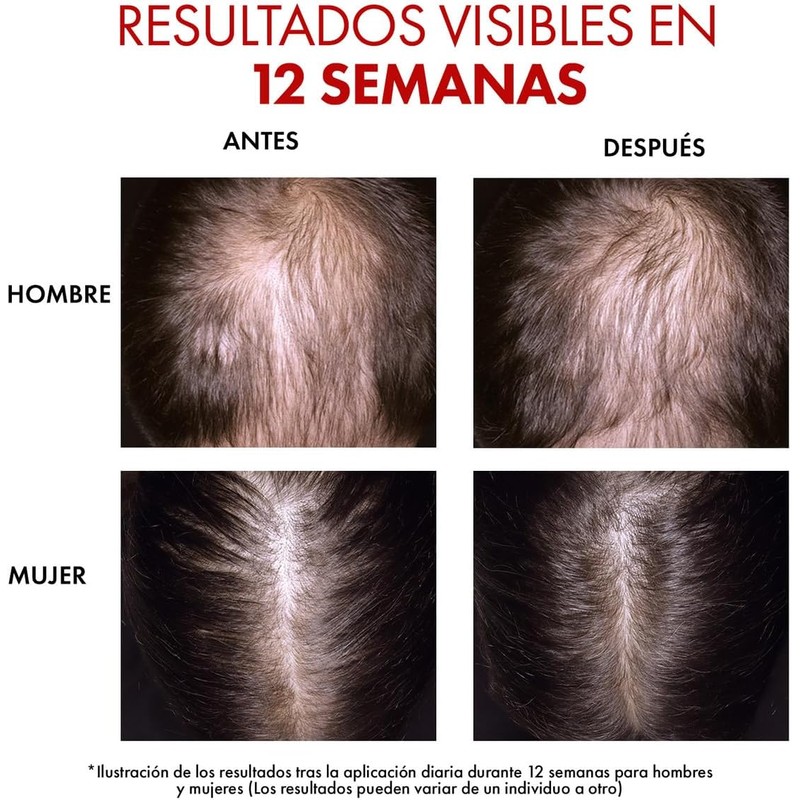 Vichy Dercos R.E.G.EN Booster Sérum Capilar Anti-Caída Dermatológico 90ml