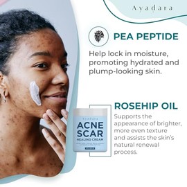 Crema Cicatrizante Avadara para Rostro y Cuerpo, Tratamiento Natural Fórmula con Aloe Vera, Miel de Manuka y Vitamina E.