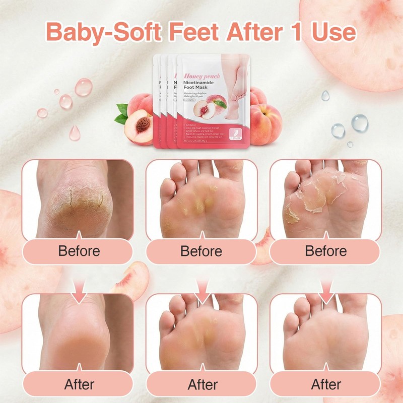atnoya 5 Pack Foot Mask, Peach Extracts Foot Peel Mask