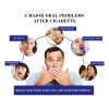 Crema Dental Para Eliminar Las Manchas De Humo Con Dientes