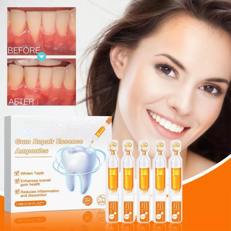 generic 14 Piezas De Gel Dental Para Restauración