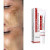 Crema Despigmentante Anti Manchas Zoo·son 20g