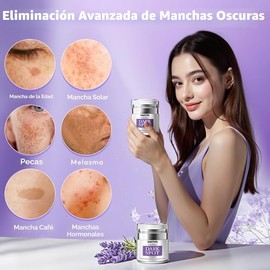 HANYWIL Eliminador de manchas oscuras para suero facial y corporal, crema correctora de manchas oscuras, tratamiento rápido de decoloración para manch