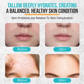 Herd & Honey Organic Tallow and Whipped Tallow Balm for Face and Body, Unscented 100% Grass Fed Beef Tallow for Skin, Dry & Sensitive Skin, Fast Absorbing, Non-greasy Honey Tallow Moisturizer, 2oz