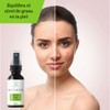 Solución Anti-acné DCI/Facial y corporal/Origen natural / 60 ml