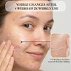Vivo Per Lei Facial Peeling, 1.7-fluid Ounce by Vivo per
