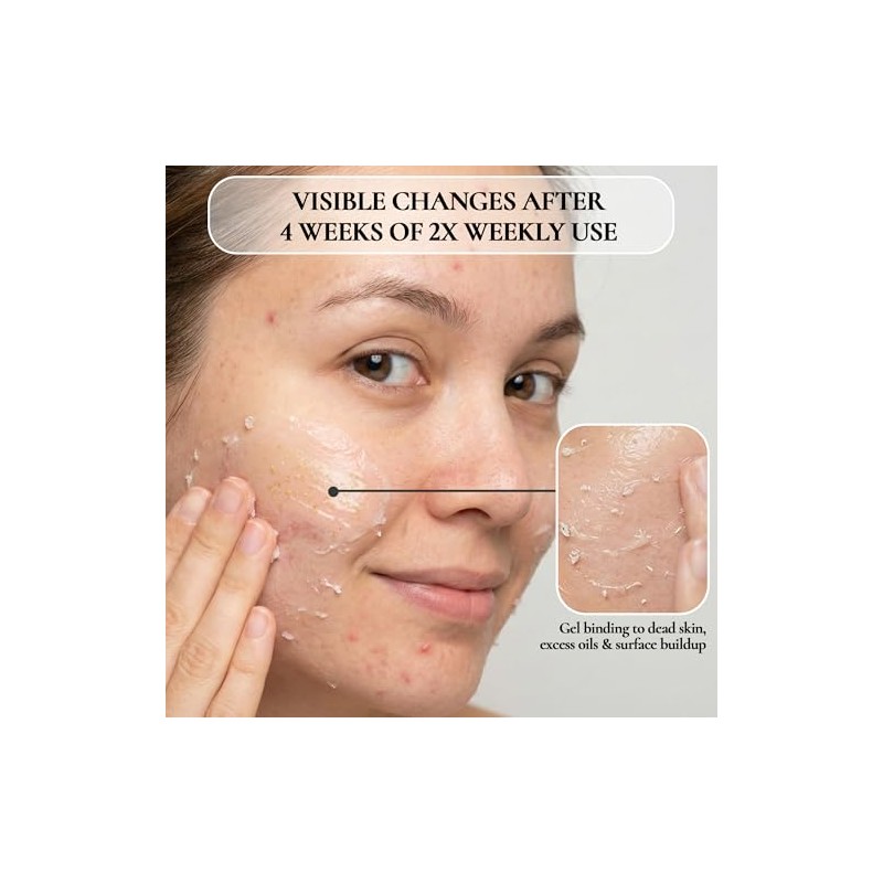 Vivo Per Lei Facial Peeling, 1.7-fluid Ounce by Vivo per