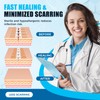 Wound Closure Device 4 Pcs - Zip Sutures & Butterfly