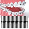 Rubber Bands for Braces, 1040 Pcs Black Orthodontic Ligature Ties