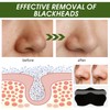 YANINEE 50PCS Mitesser Nase Pore Strips Nntfernen, Mitesserentferner Stripes für
