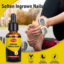 Pjordo Ingrown Toenail Removal Kit - 30ml/1oz Ingrown Toenail Drops Toenail Softener with 3 Gel Toe Tubes, Nail Clipper, Ingrown Toenail File Lifter, Ingrown Toenail Corrector Drops