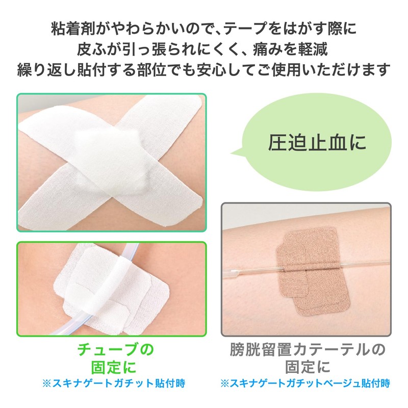 Nichiban SGG75 Skinagate Gachit 3.0 inches (75 mm) x 16.4