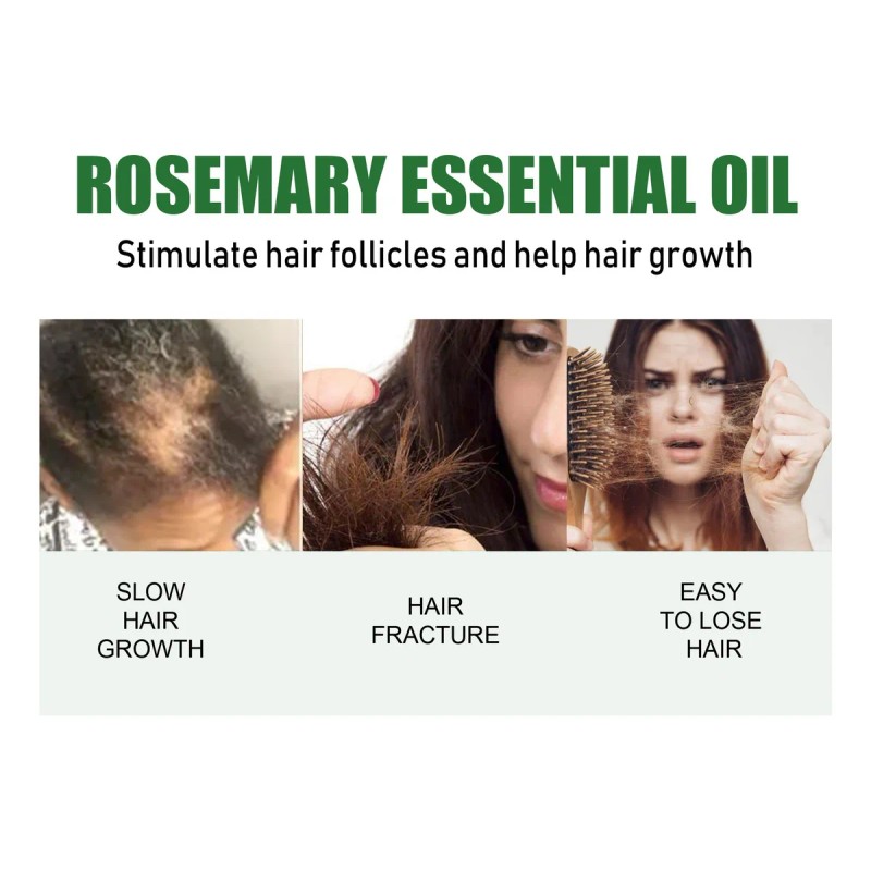 Aceite Esencial De Romero Para El Crecimiento Del Cabello