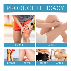 2PCS Anti Chafe Stick,Anti Chafing Cream,Glide Anti Chafing Stick,Thigh Chafing Cream,Thigh Rub Stick,Dark Inner Thigh Treatment,Applicable to Heel,Lower Arm,Legs,Safe and Mild Ingredients,Easy to Use
