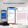 EKG Smart Blood Pressure Monitor with AI ECG Analysis Afib