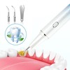 Plaque Remover for Teeth with Camera Teeth Dental Calculus Remover