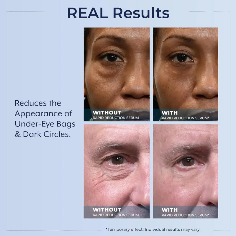 Sérum Contorno De Ojos Plexaderm Rapid Reduction: Reduce Vis