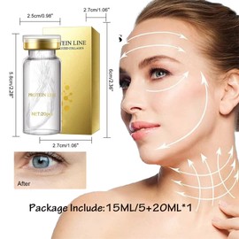 Mikabila (08) InstaLift Protein Thread Lifting Set, Collagen Silk Threads for Silk Thread Lifting Thread Lifting for Skin Tightening, Lifting Face for Lifting the Jaw Line, 15 ml + 20 Pieces