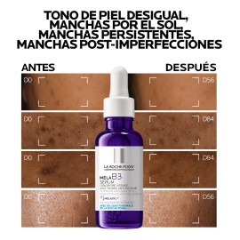 Sérum Concentrado Mela B3 La Roche-Posay Antimanchas 30ml con Melasyl y 10% Niacinamida Previene la Reaparición