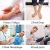 Shuyan Jiao AFO Foot Drop Brace Ankle Foot Orthosis Medical