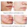 Srum Reafirmante Facial Con cido Hialurnico Para Arrugas