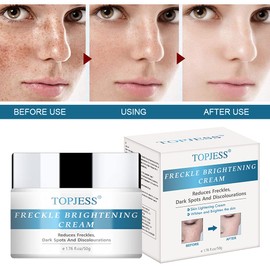 Allergika Sensitive Face Cream 50 ml