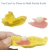 Fake Teeth-DIY Dentures-Customizable Denture Solution for Fixing the Missing and