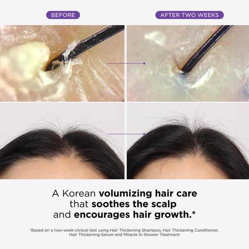 Dr. Groot Complete Hair Loss Reduction Set | Full-Size Shampoo,