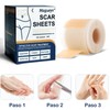 🩹✨ ¡Adiós Cicatrices! Parches de Silicona Premium - 1.5M Largo