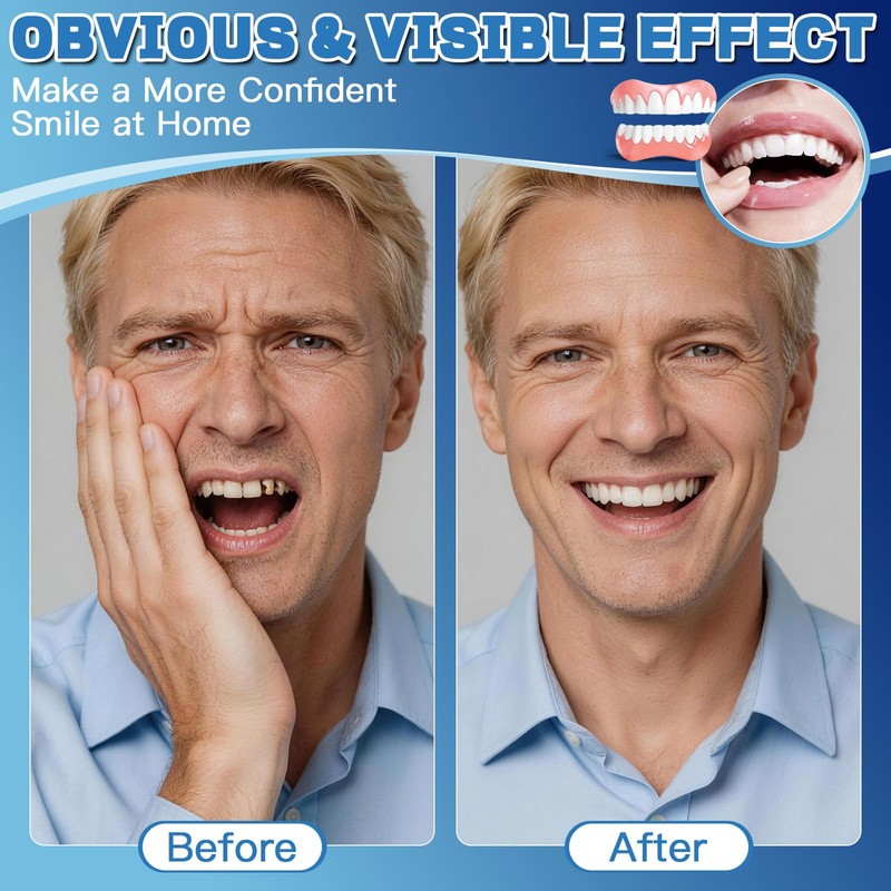 Moldable False Teeth Dentures Set for Women Men – Upper