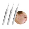 [HYEF90M6_56] Skin Sebum Extractor Blackhead Extraction 3-Piece Set / [HYEF90M6_56]피부 피지압출기 블랙헤드 압출 3종세트