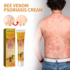 South Moon Bee Venom Psoriasis Cream,   Skin  Hand Moss Moisturizing Skin Care Cream:_4pcs_default