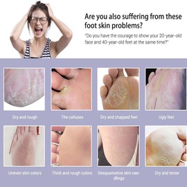 3 Packs Lavender Foot Mask - Soft Ingredient Foot Peel Mask for Hard Skin - Exfoliating Foot Mask Removes Dry Dead Skin - Hydrating Foot Snocks for Dry&Rough&Cracked Feet Care