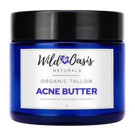 Wild Oasis Naturals Organic Beef Tallow Acne Butter Cream for Skin, Face & Body - 100% Grass Fed, Shea Butter, Almond Oil & Essential Oils as Moisturizer | Natural Anti-Flammatory Ingredients - 2oz