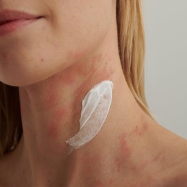 DADO SENS EXTRODERM HAUTBALSAM Sondergröße 250ml - Bei Neurodermitis & Psoriasis, Pflegt und Beruhigt Trockene Haut Jeden Alters Besonders Sanft, Feuchtigkeitsspendend, Vegan