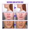Tratamiento Crema Elimina Papada Moldea El Rostro No Serum Todo