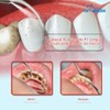 Punta dental mixta P1 10 ajuste de escala EMS, pájaro
