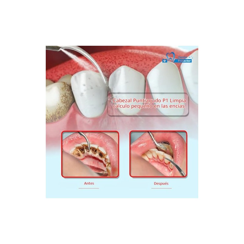 Punta dental mixta P1 10 ajuste de escala EMS, pájaro
