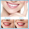 NITAIUN Pack of 2 Veneers Teeth Dentures Instant Veneers Dentures