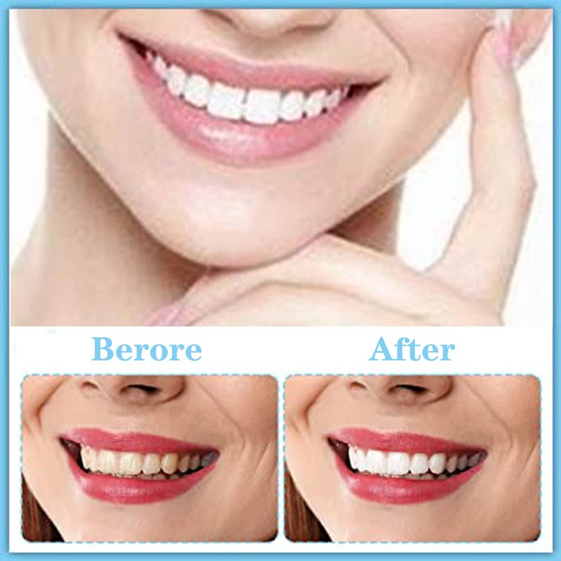NITAIUN Pack of 2 Veneers Teeth Dentures Instant Veneers Dentures